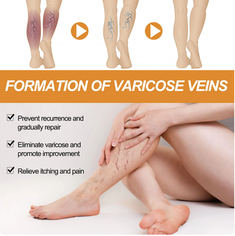Turmeric Varicose Veins Relief Spray (BUY 1 GET 1 FREE)