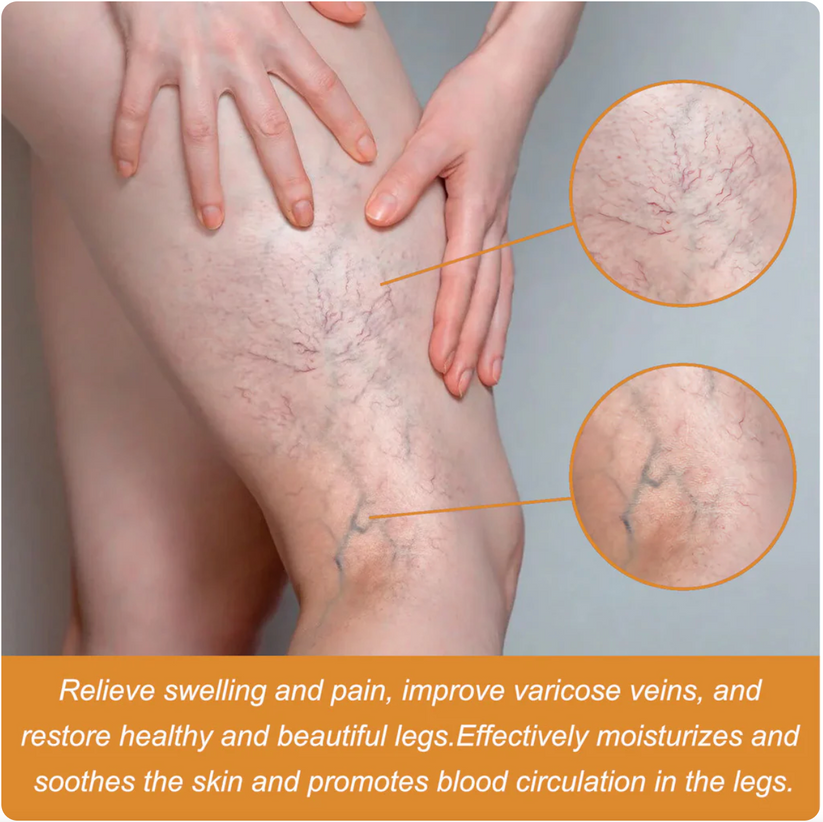 Turmeric Varicose Veins Relief Spray (BUY 1 GET 1 FREE)
